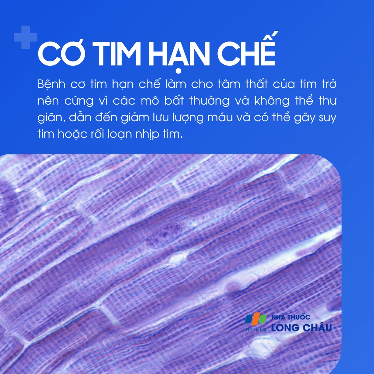 Cơ tim hạn chế 1