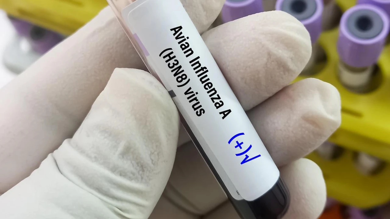 Cúm H3N8 là gì? Những điều cần biết về virus cúm H3N8 ở người 1