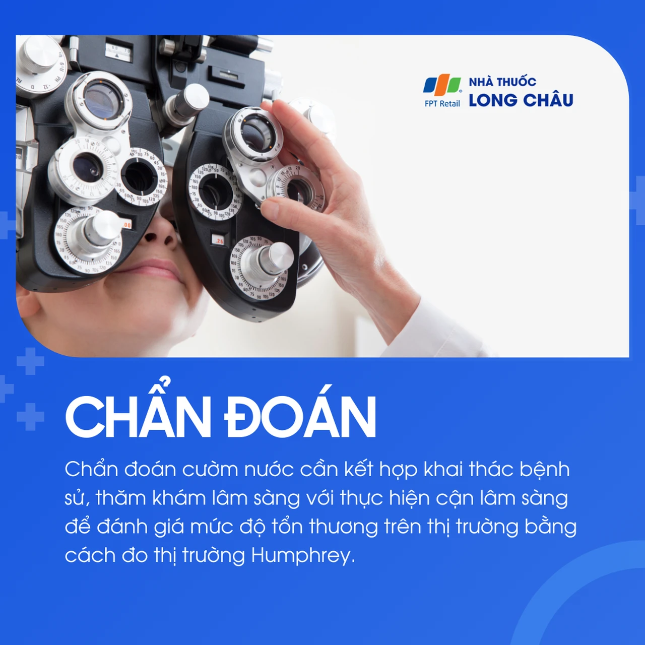 Cườm nước được chẩn đoán bằng khám mắt, đo thị trường, đánh giá mức độ tổn thương thị giác