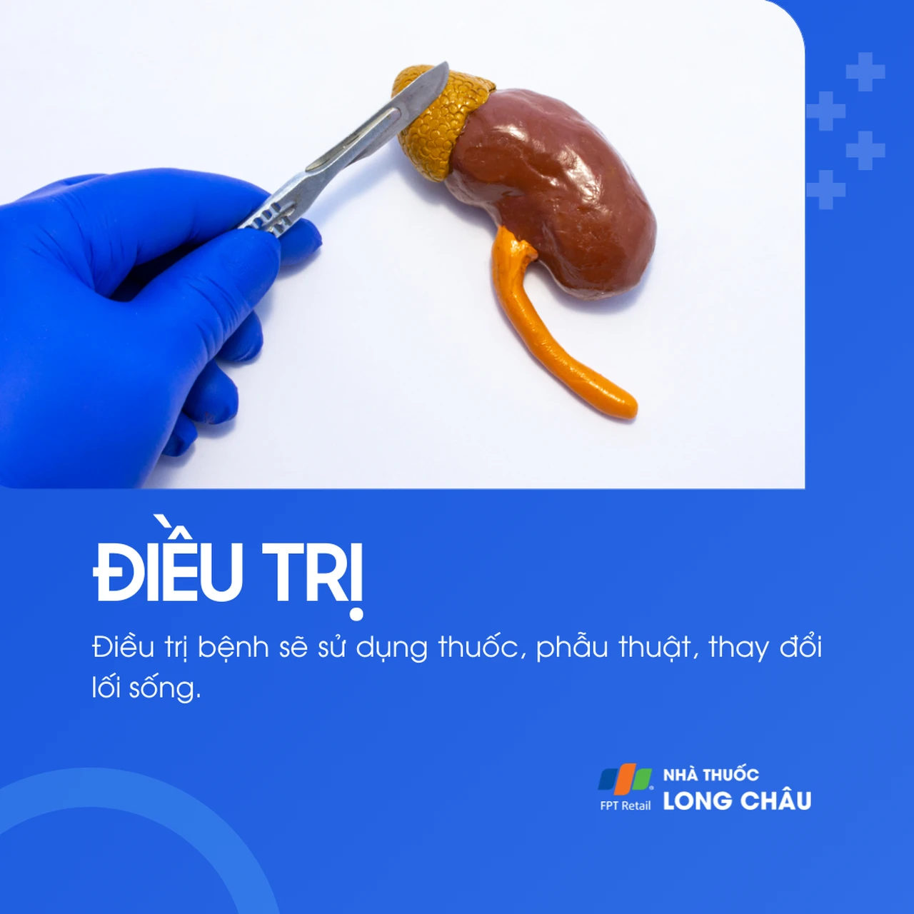  Cường aldosteron 6