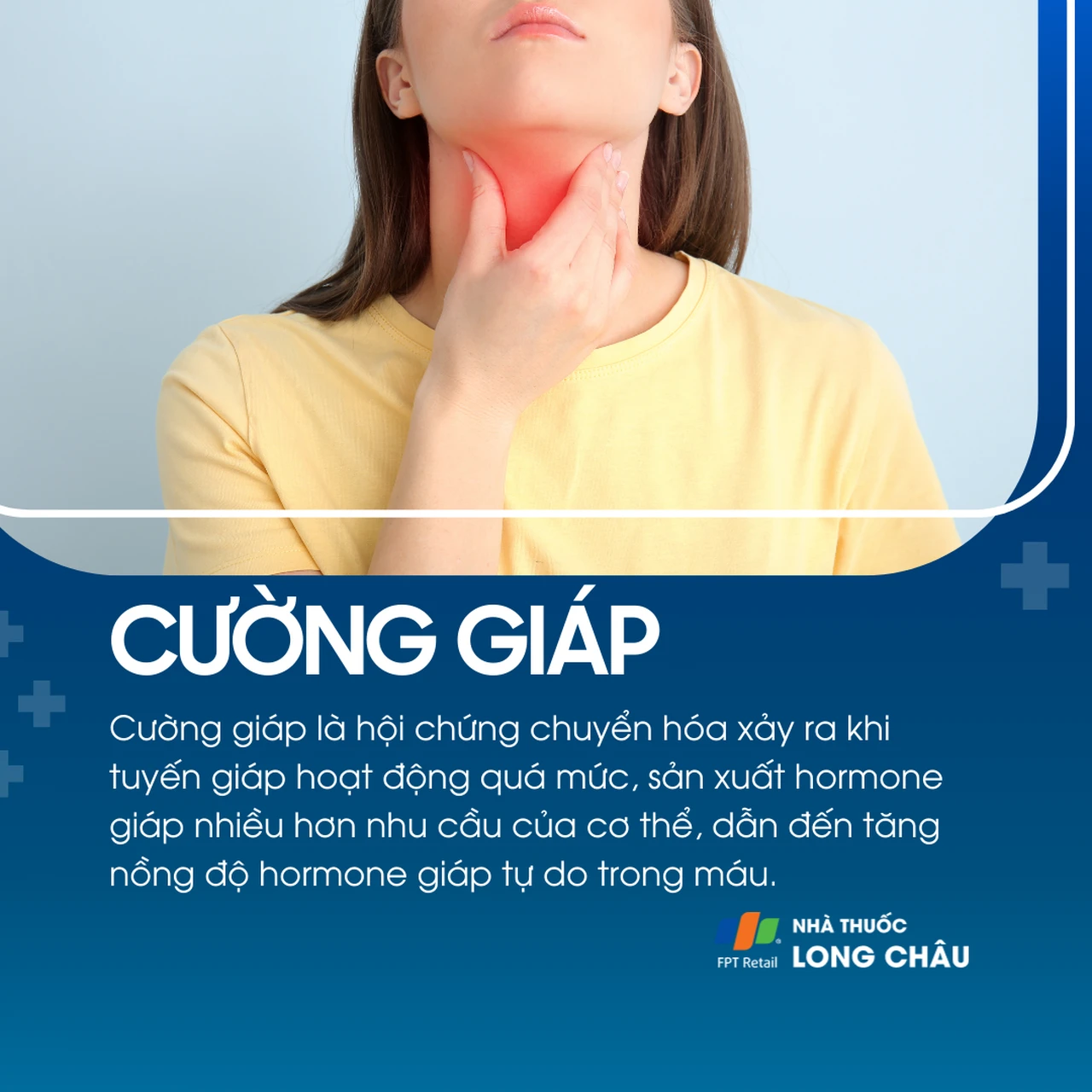 Cường giáp là tình trạng tuyến giáp hoạt động quá mức, khiến hormone giáp trong máu tăng cao
