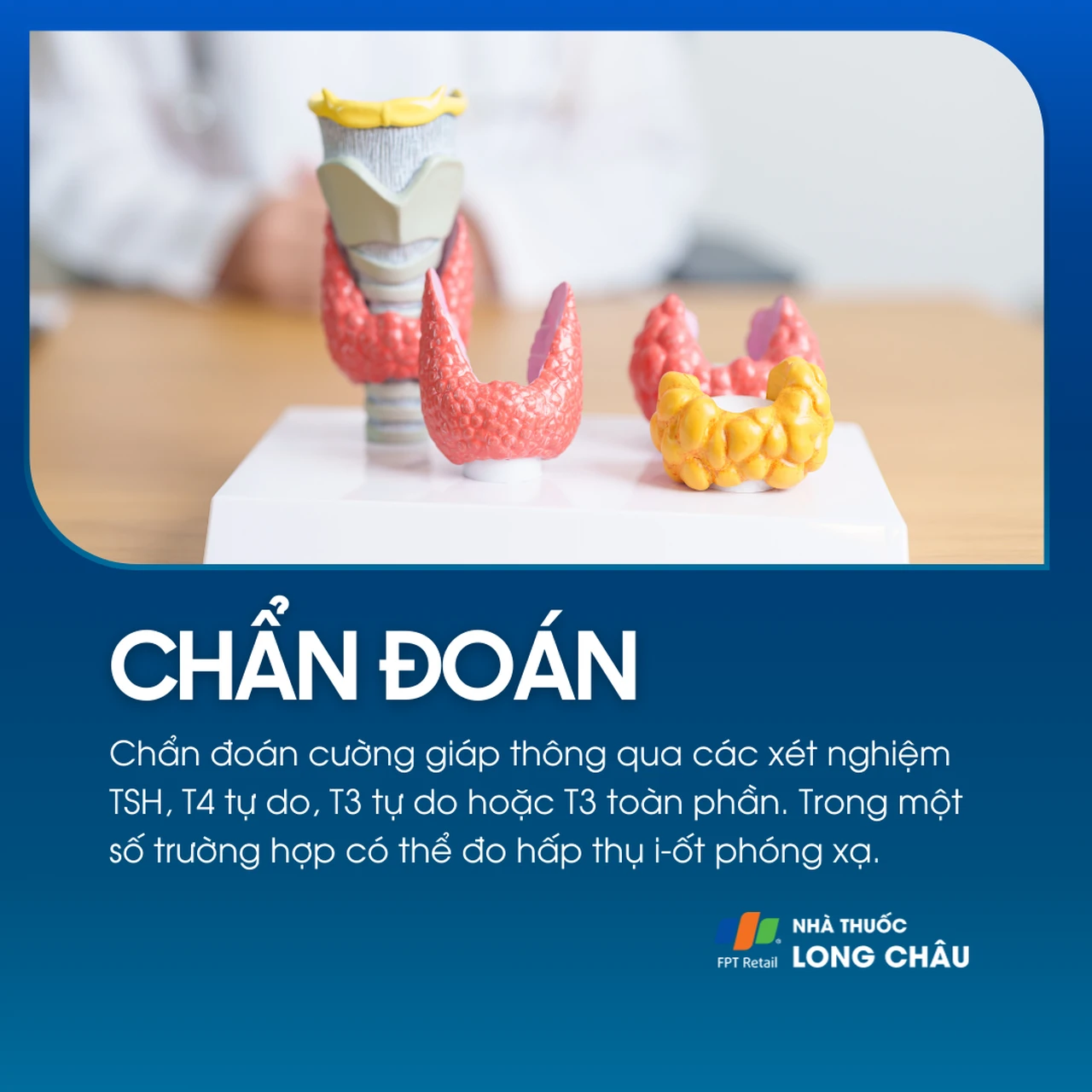 Chẩn đoán dựa trên xét nghiệm TSH, T3, T4, hoặc hấp thu iod phóng xạ