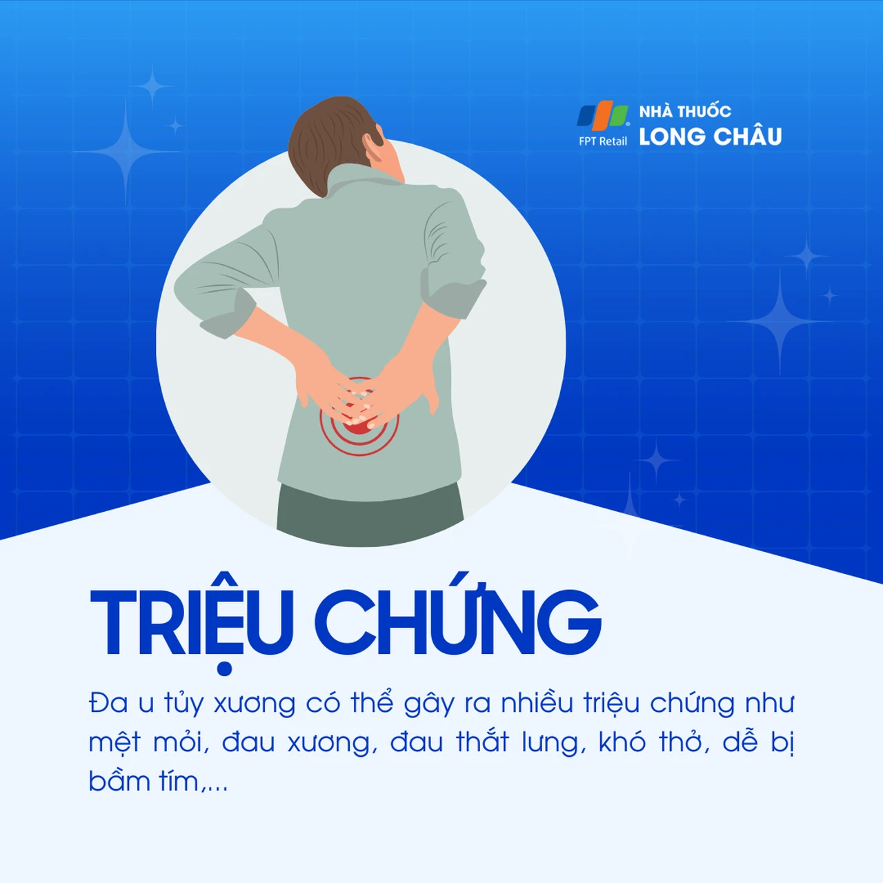 Đa u tủy xương 2