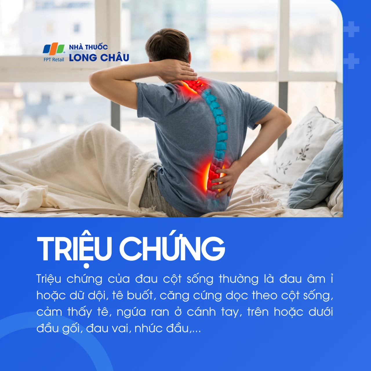 Triệu chứng của đau cột sống gồm: đau âm ỉ/dữ dội, căng cứng dọc theo cột sống, tê buốt, nhức đầu, đau lan xuống chân hoặc ta