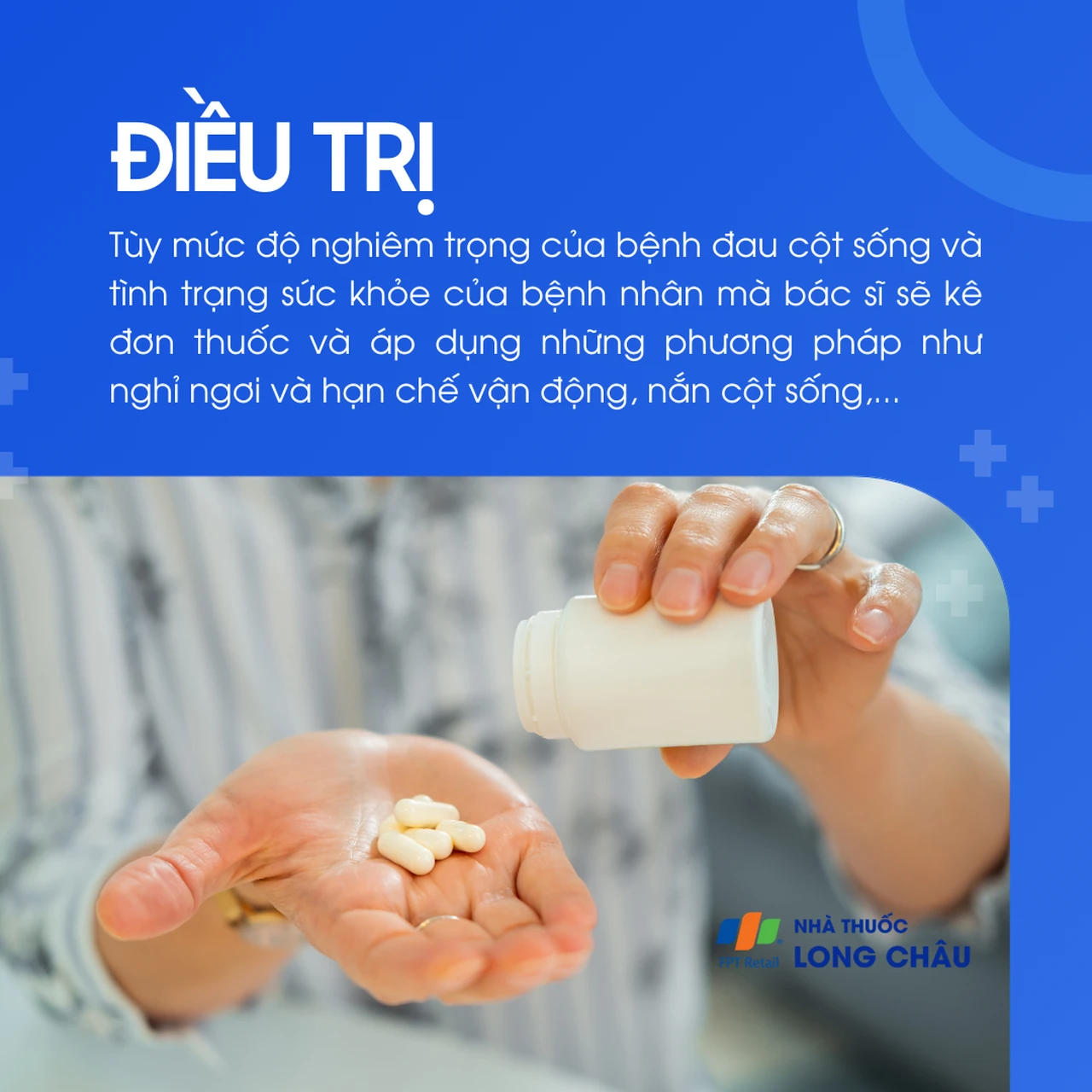 Điều trị đau cột sống tùy theo mức độ nặng nhẹ, thường gồm dùng thuốc, nghỉ ngơi, hạn chế vận động và nắn chỉnh xương khớ