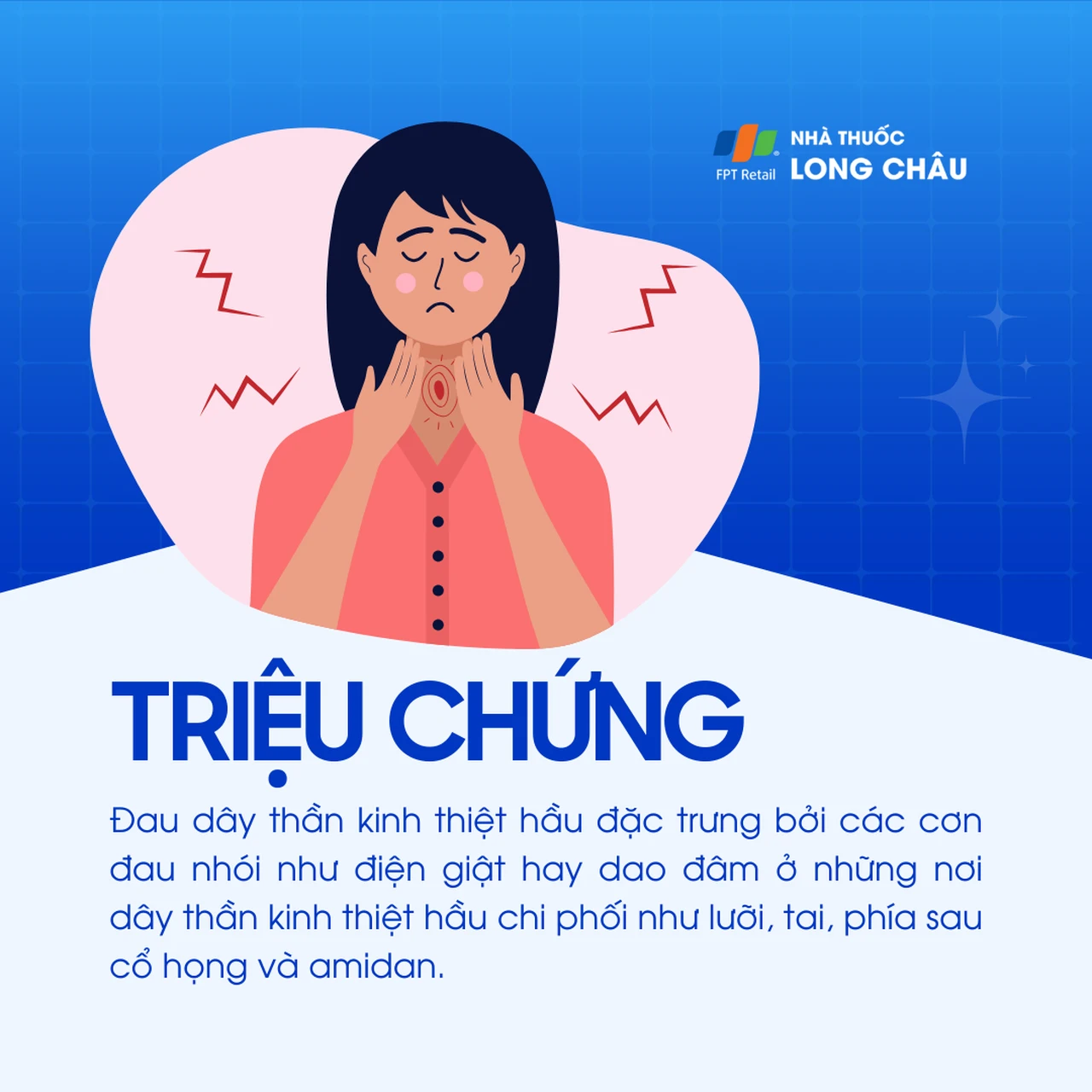 Đau dây thần kinh thiệt hầu 2