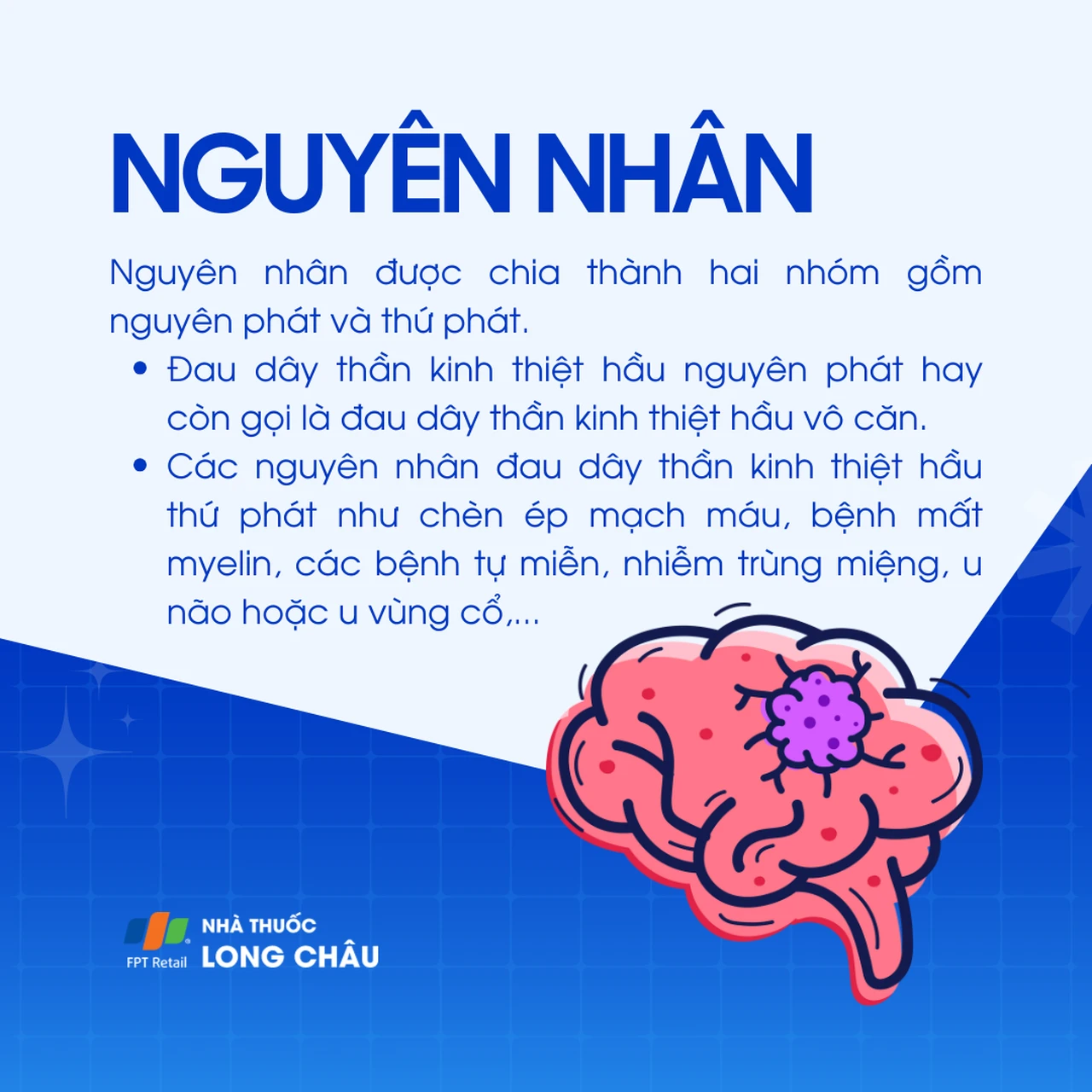 Đau dây thần kinh thiệt hầu 3