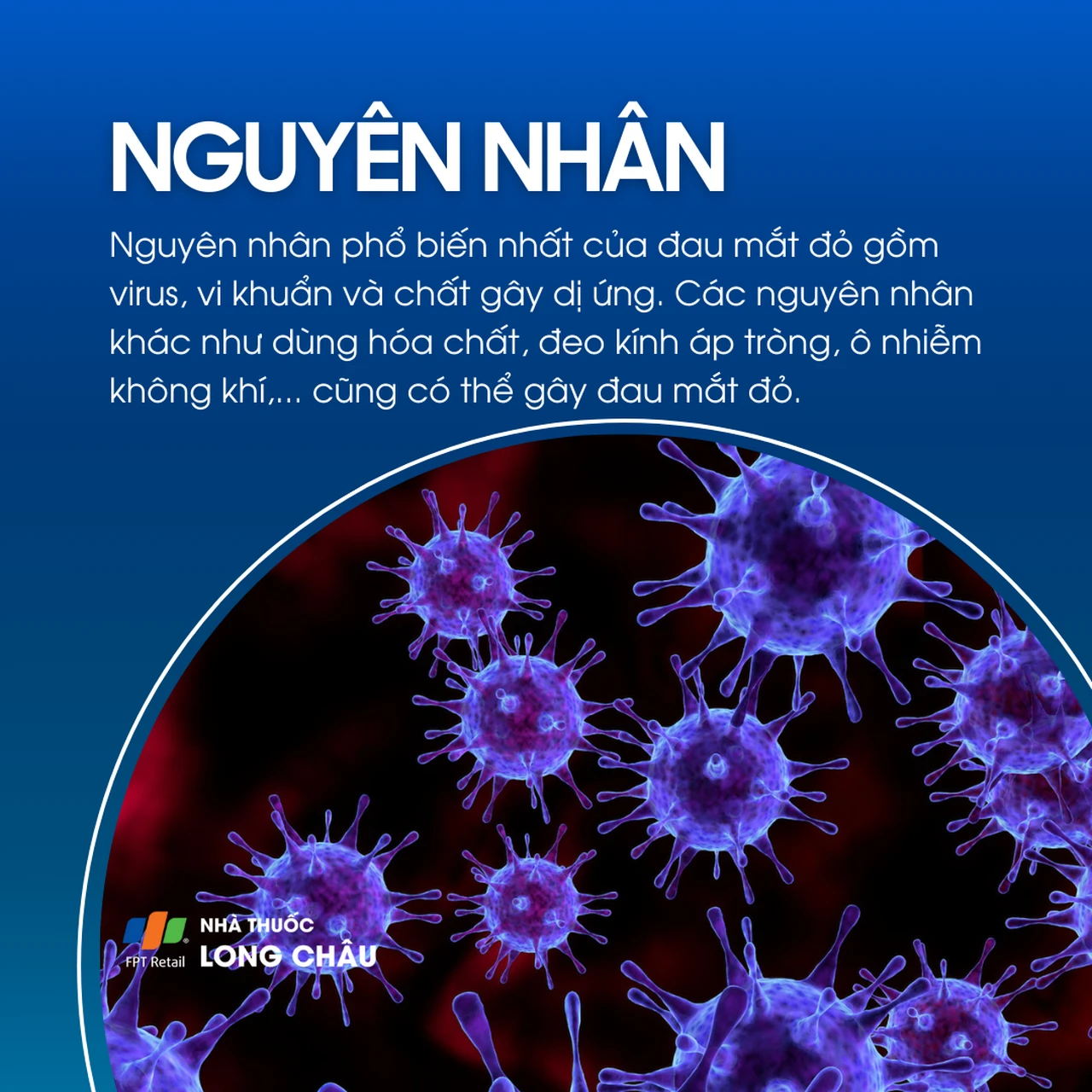 Nguyên nhân gây đau mắt đỏ thường do virus, vi khuẩn hoặc dị ứng