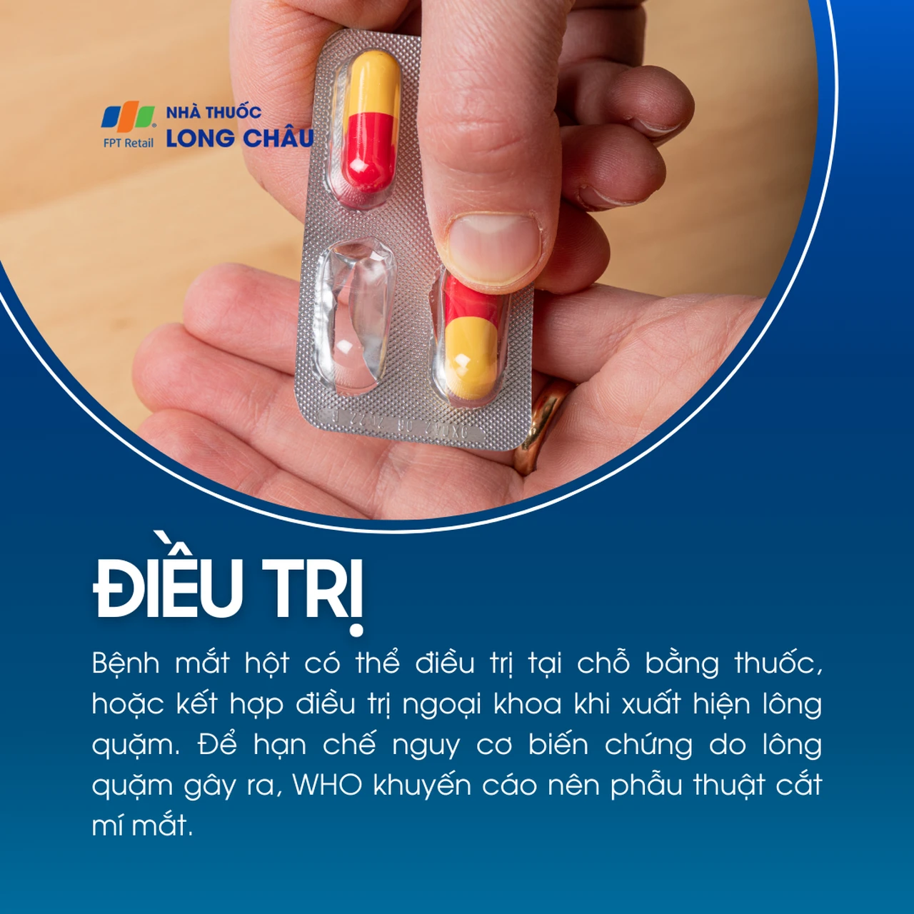 Đau mắt hột 6