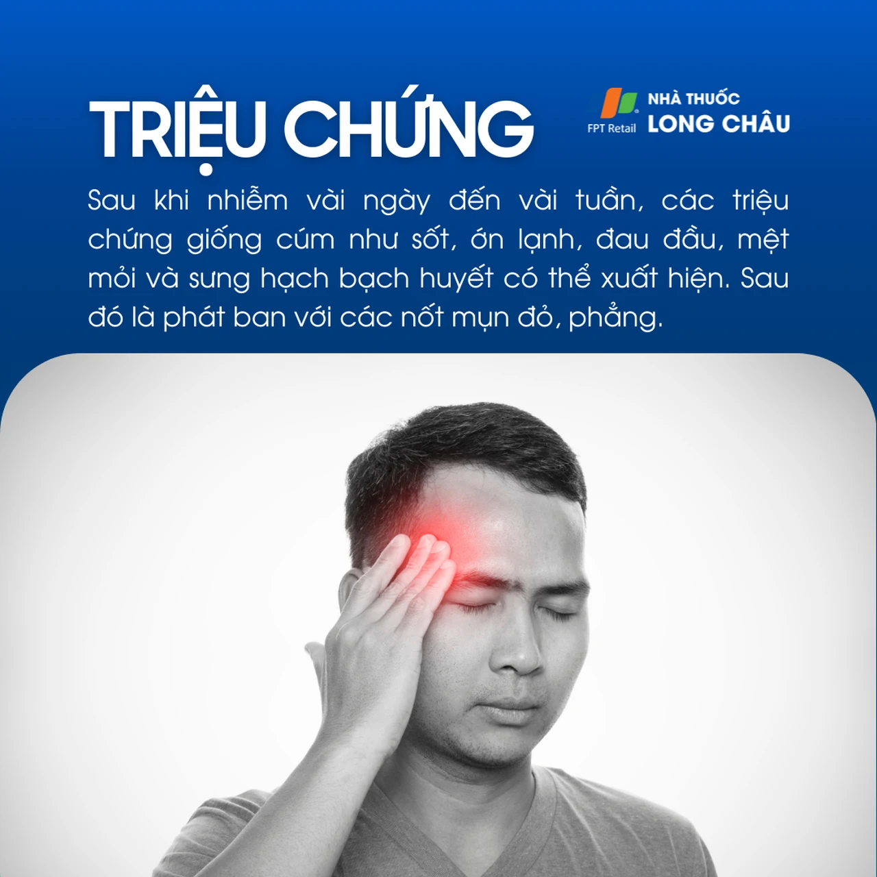 Đậu mùa khỉ 2
