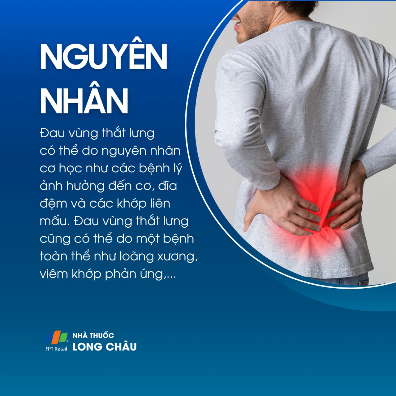 Đau vùng thắt lưng 3