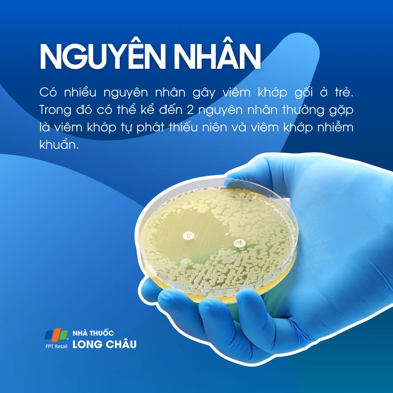 Viêm khớp gối ở trẻ em 3