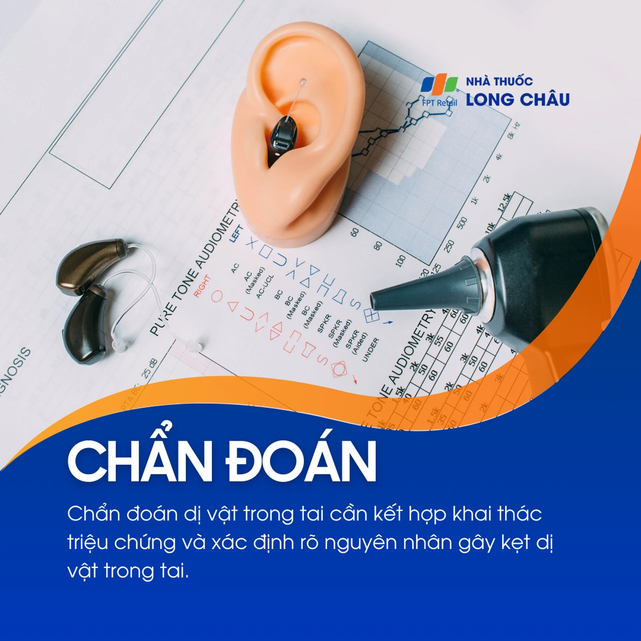 Dị vật trong tai 5