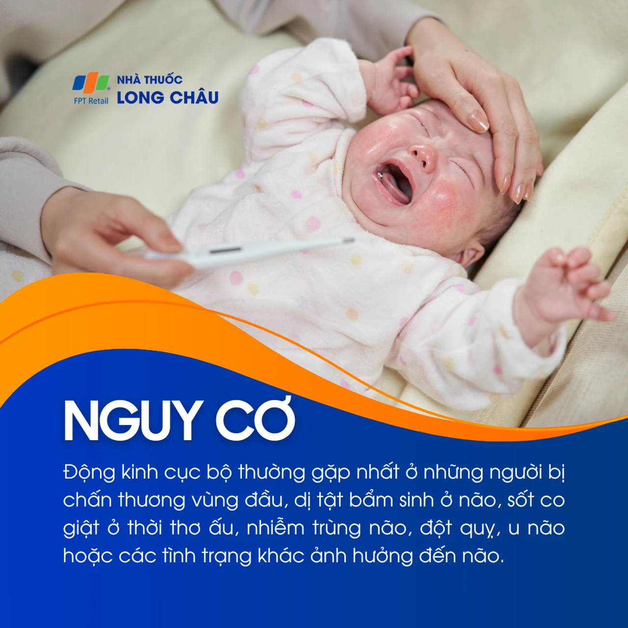 Động kinh cục bộ 4