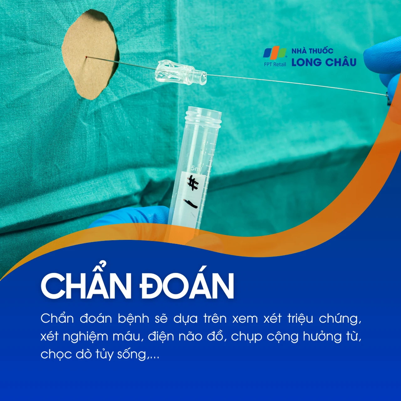 Động kinh cục bộ 5