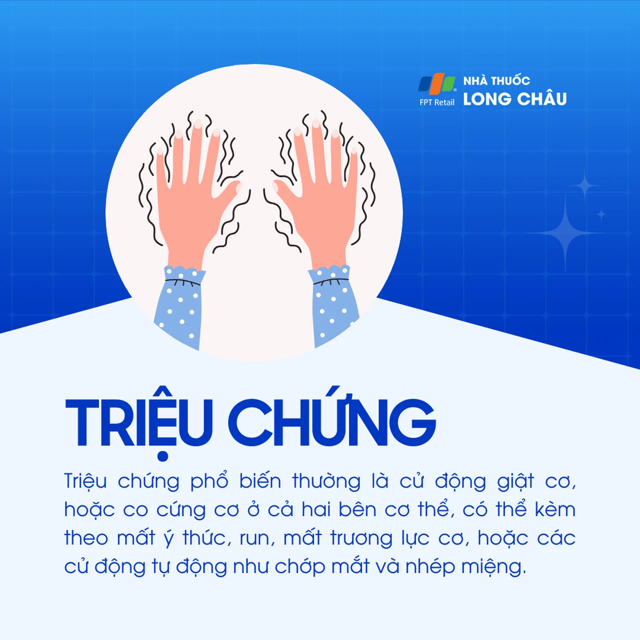 Động kinh toàn thể 2