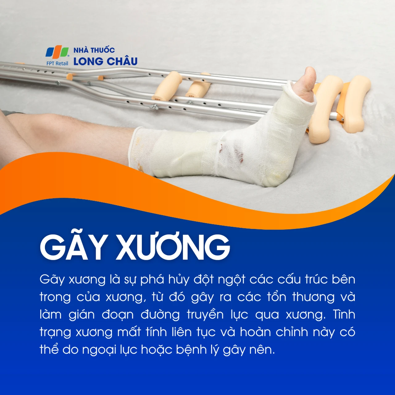 Gãy xương 1