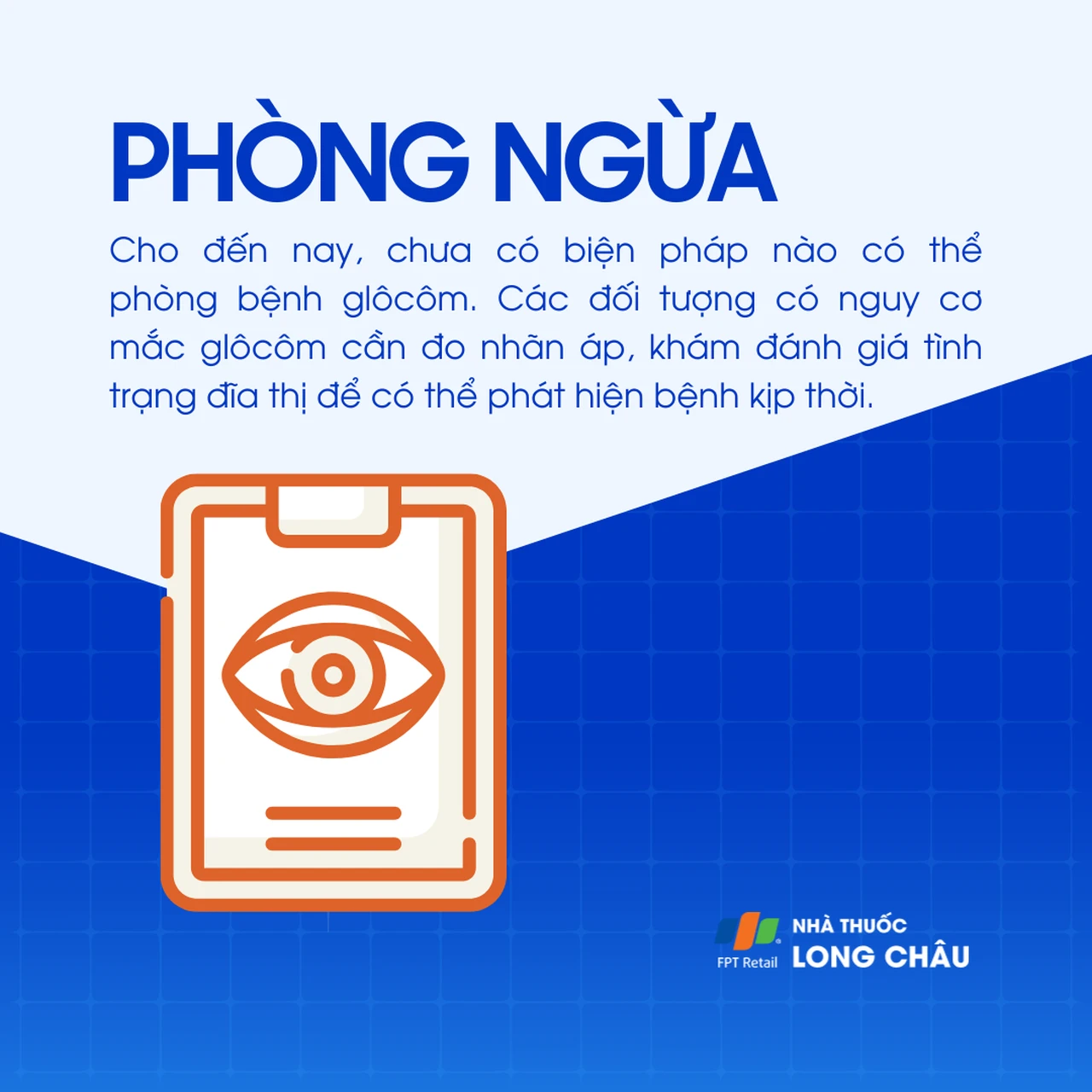 Glôcôm góc đóng nguyên phát 8