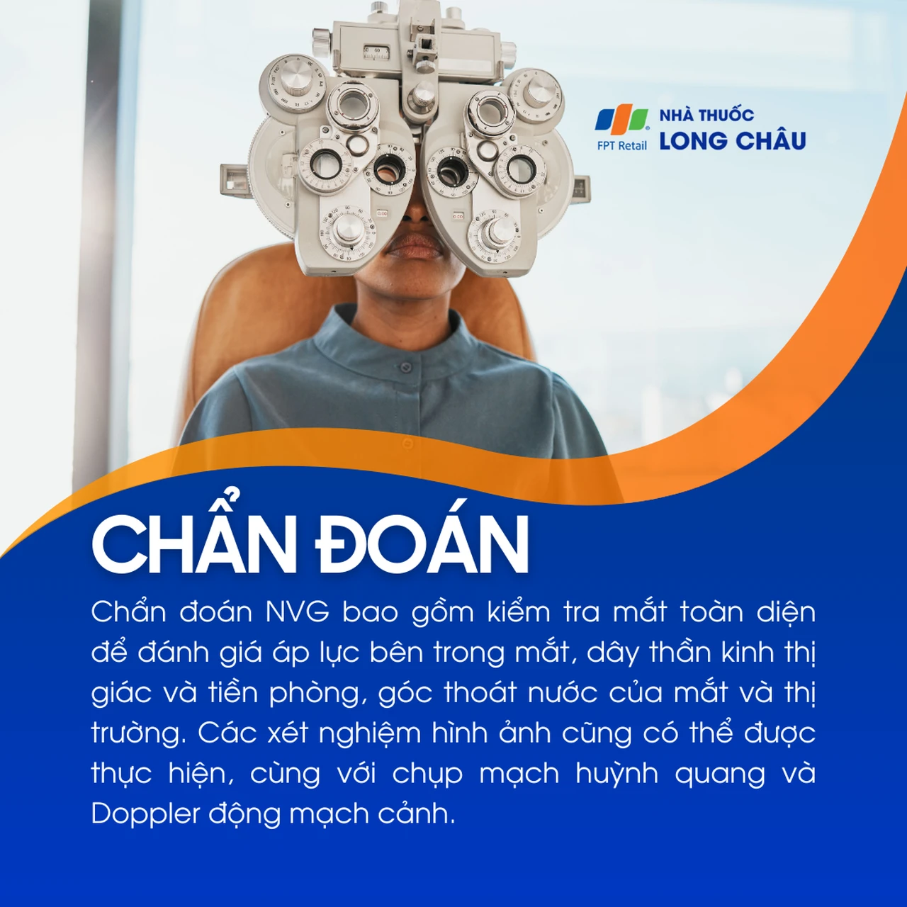 Glocom tân mạch 5