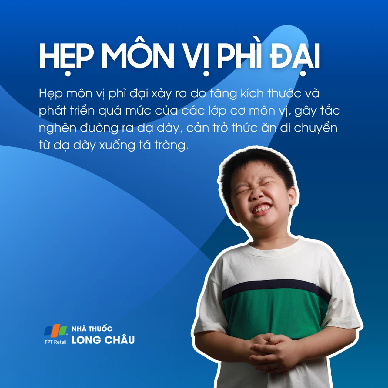 Hẹp môn vị phì đại 1