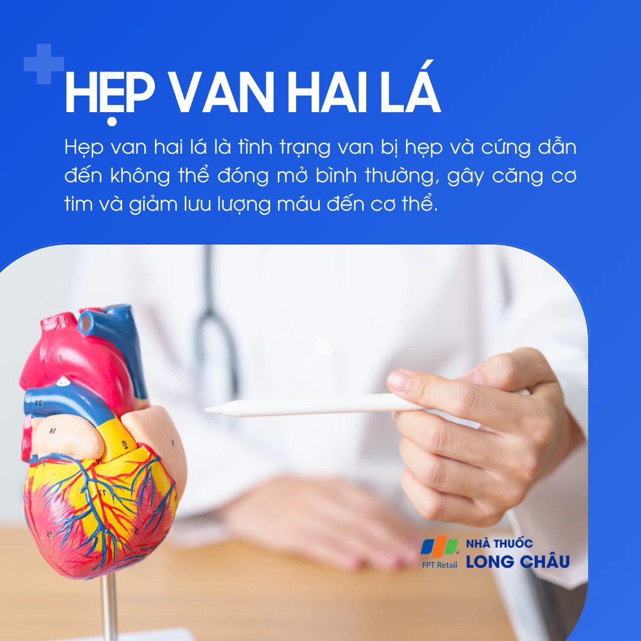 Hẹp van hai lá 1