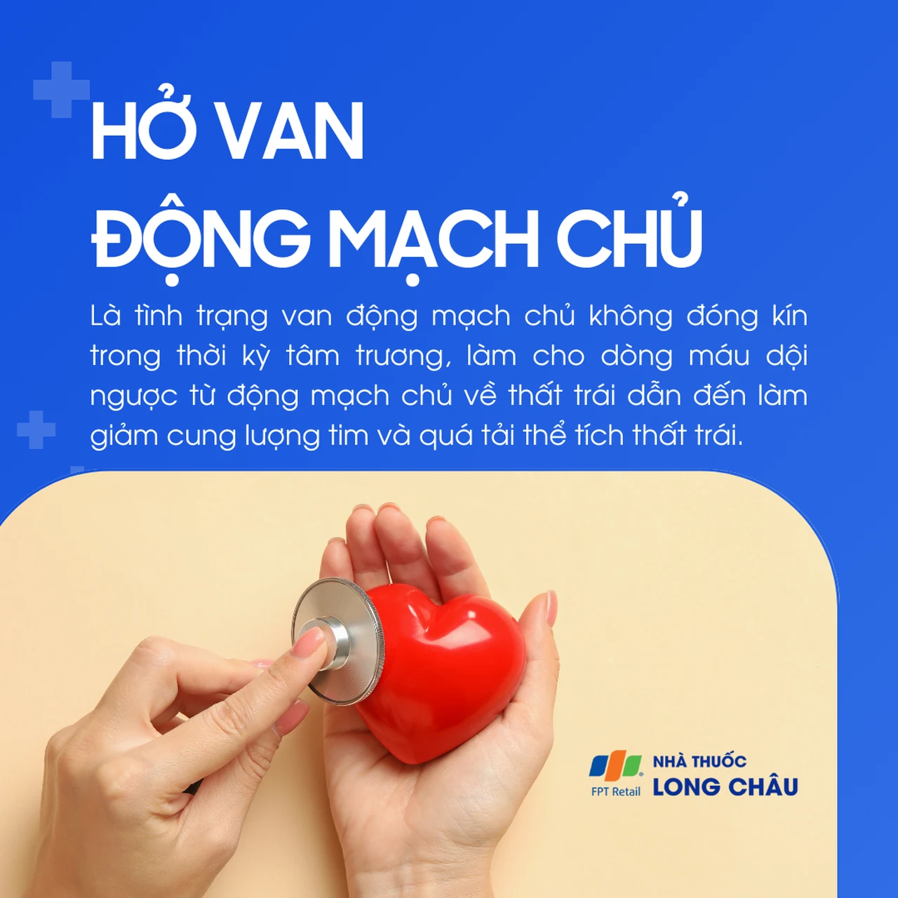 Hở van động mạch chủ 1