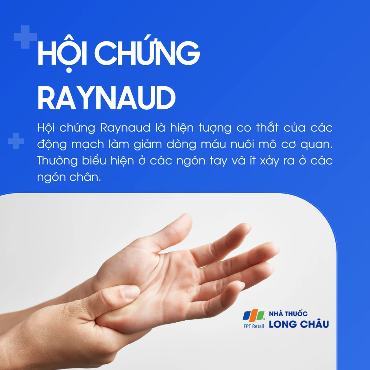 Hội chứng raynaud 1