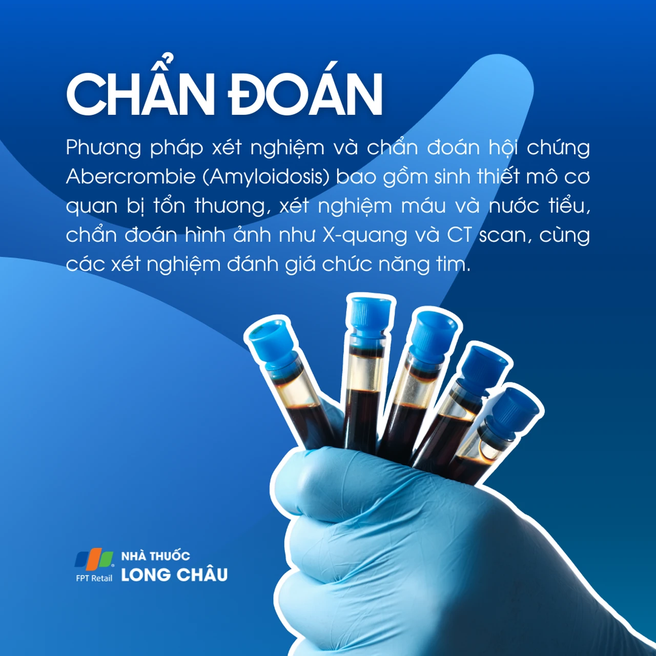 Hội chứng Abercrombie 5