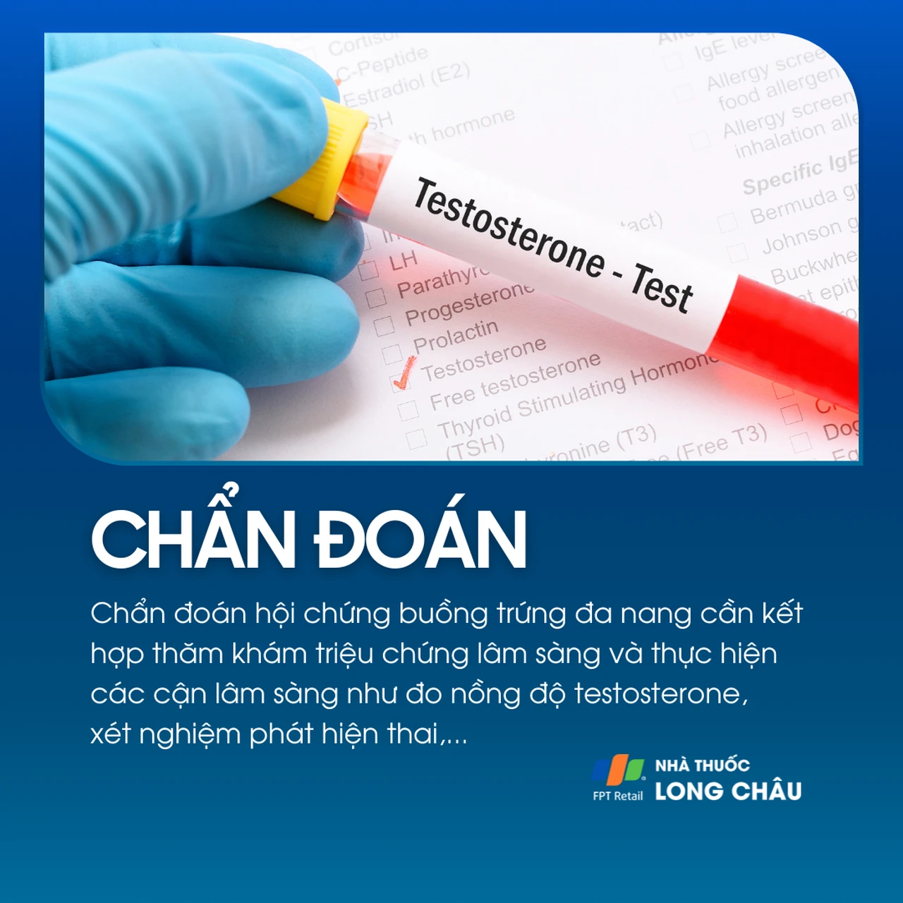 Hội chứng buồng trứng đa nang 5