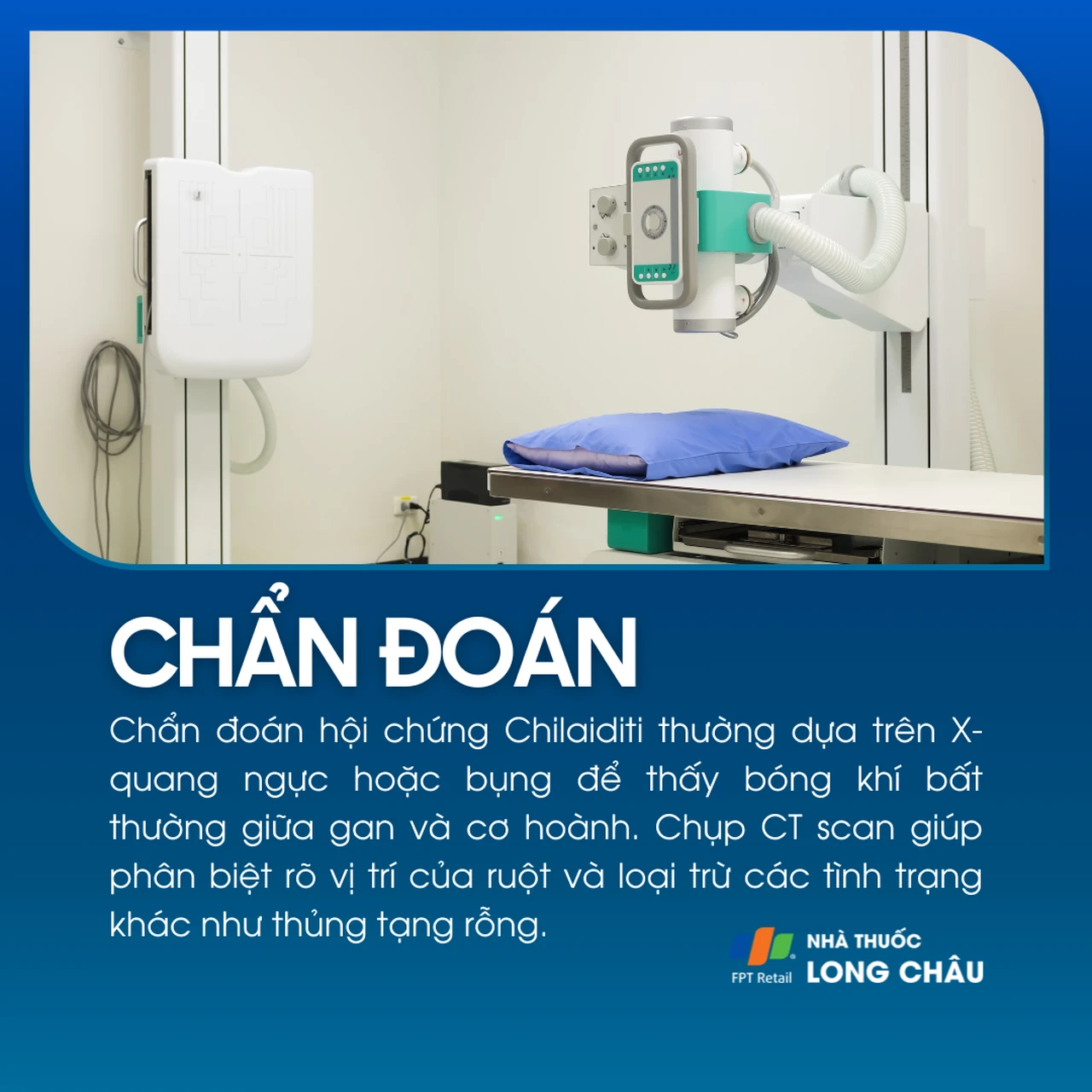 Hội chứng Chilaiditi 5