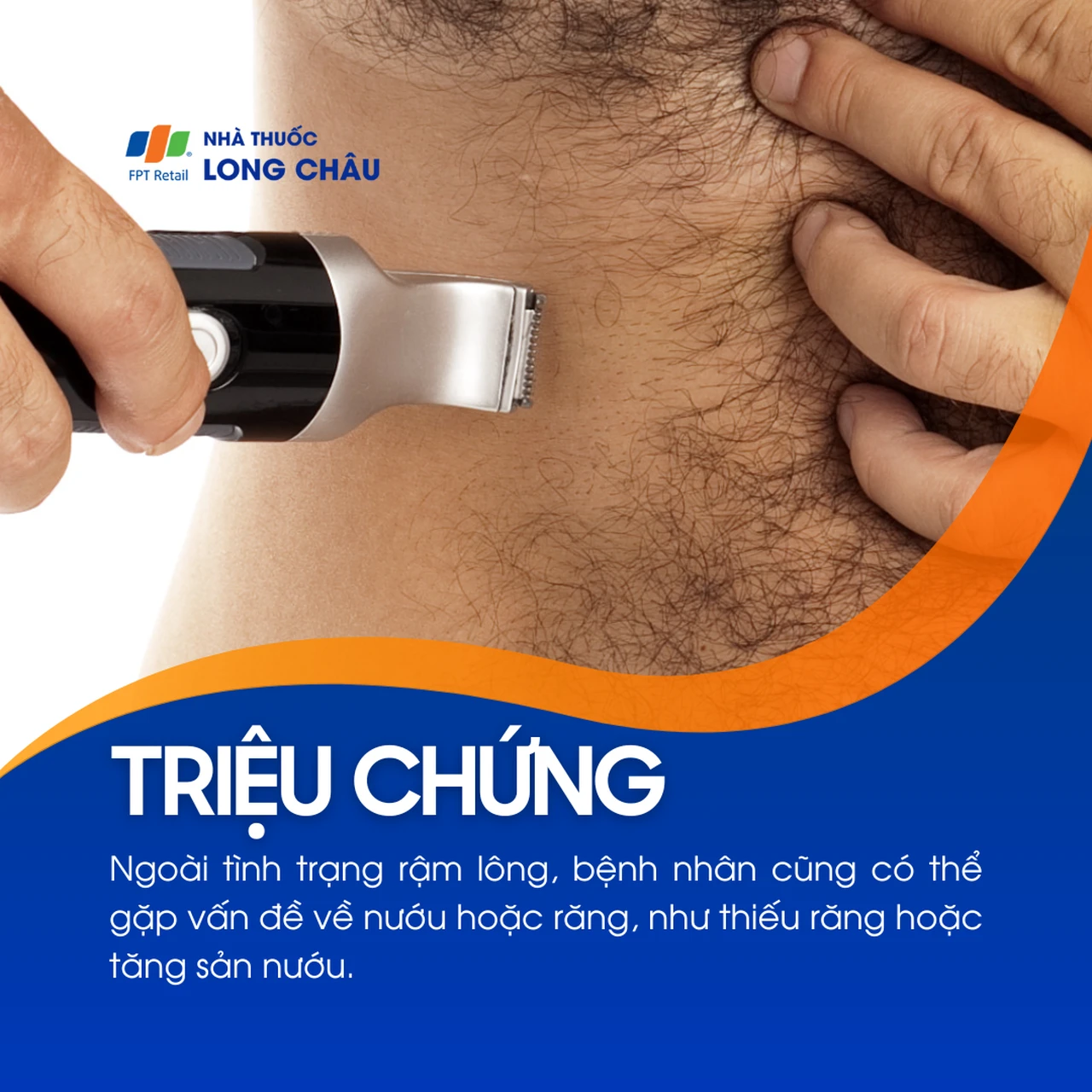 Hội chứng người sói 2