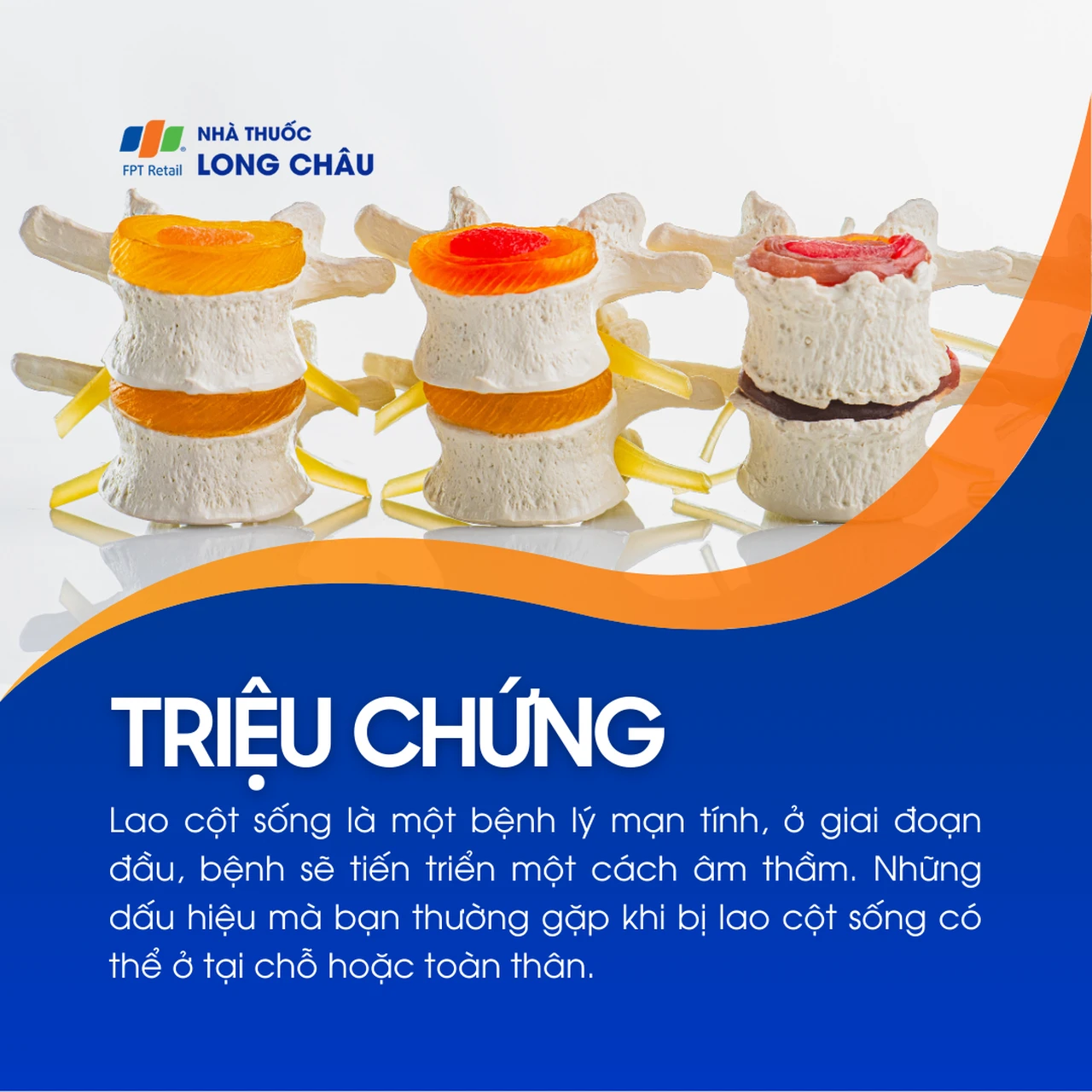 Lao cột sống 2