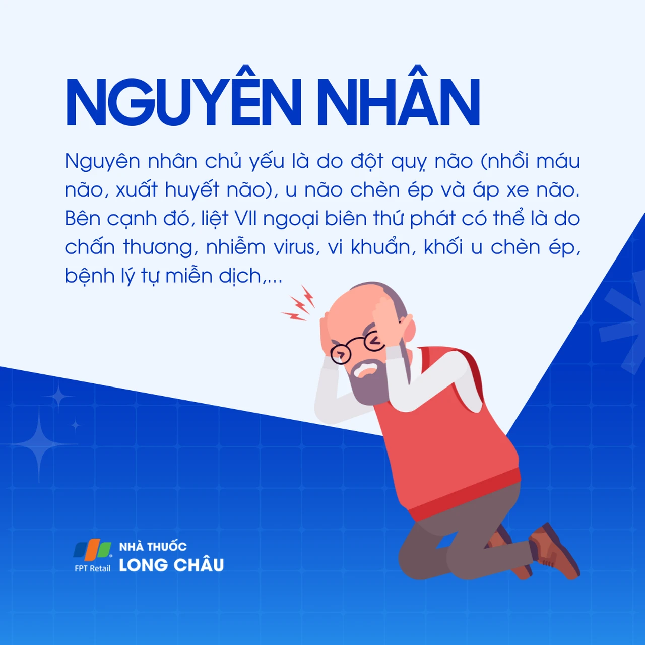 Liệt dây thần kinh số VII 3