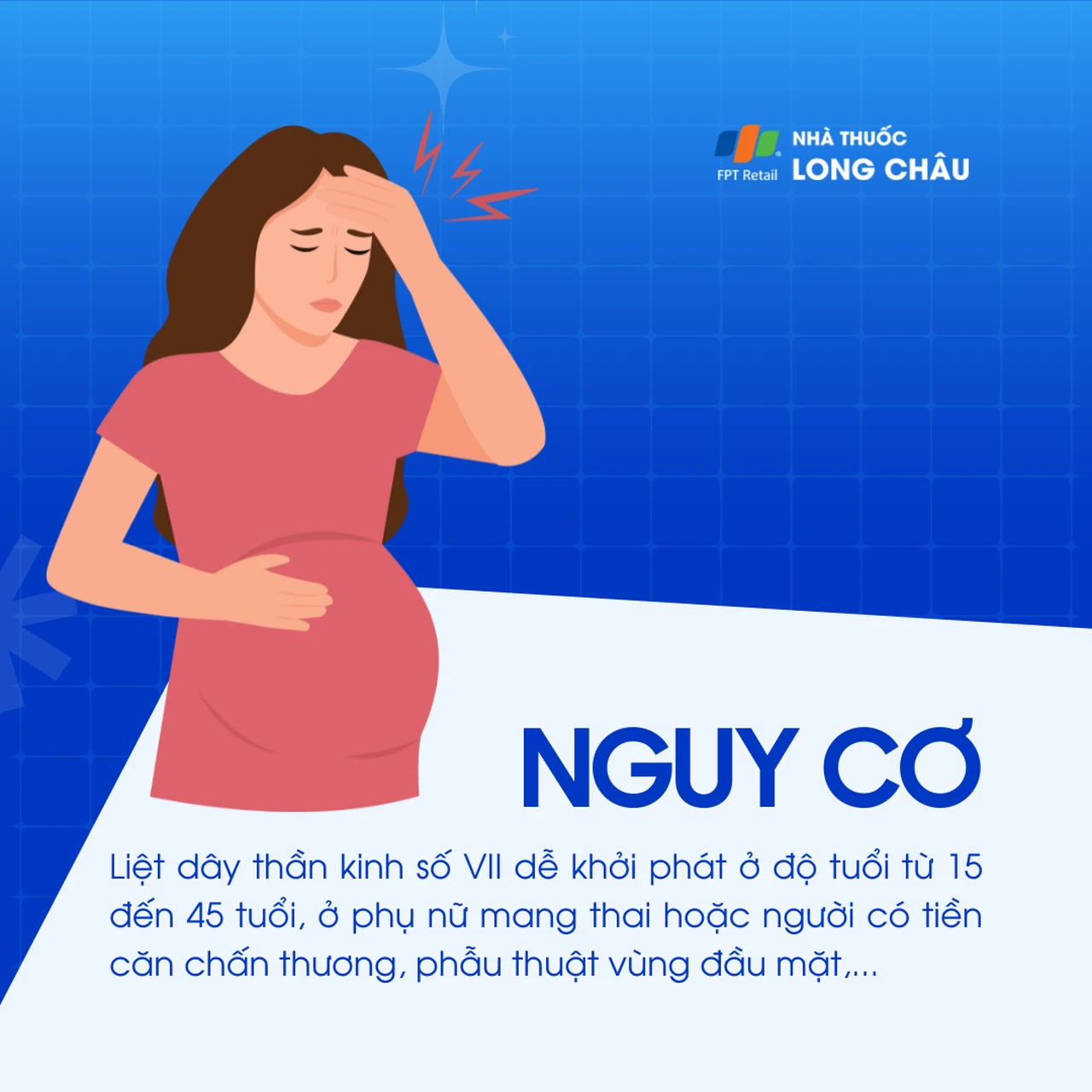 Liệt dây thần kinh số VII 4