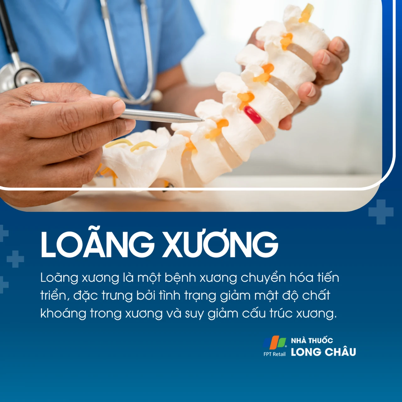 Loãng xương 1