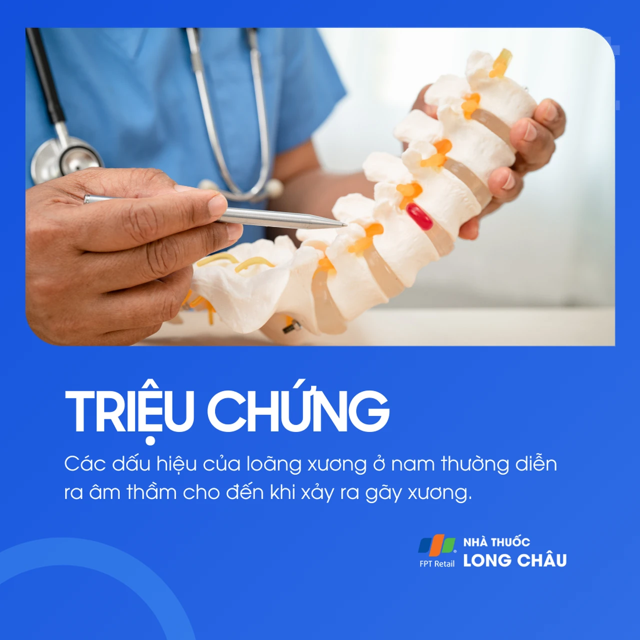 Loãng xương ở nam 2