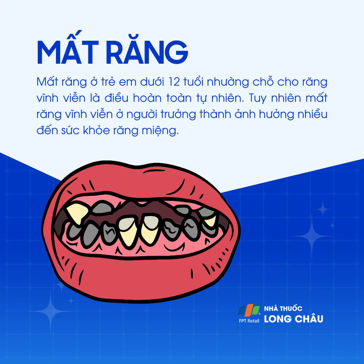 Mất răng 1