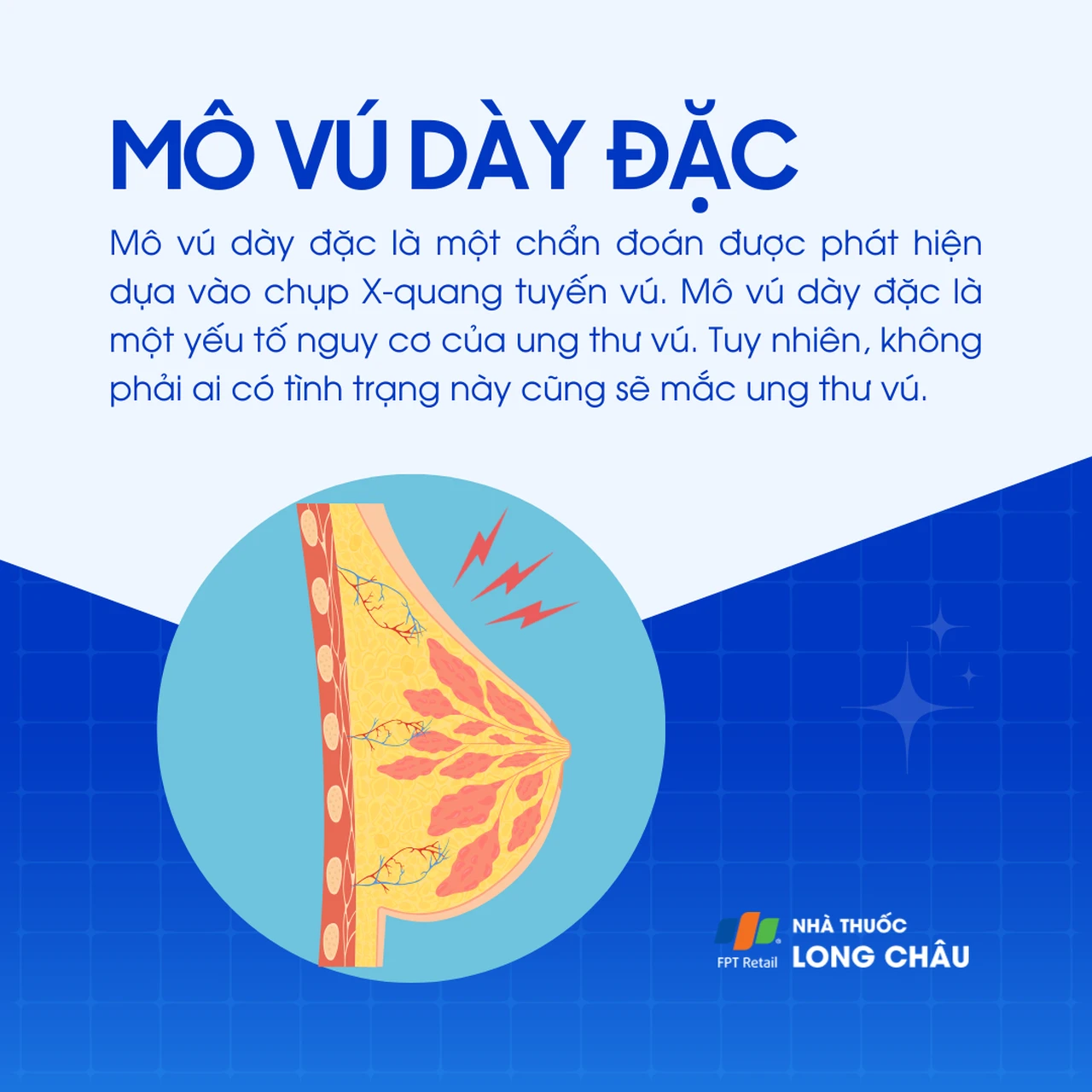 Mô vú dày đặc 1