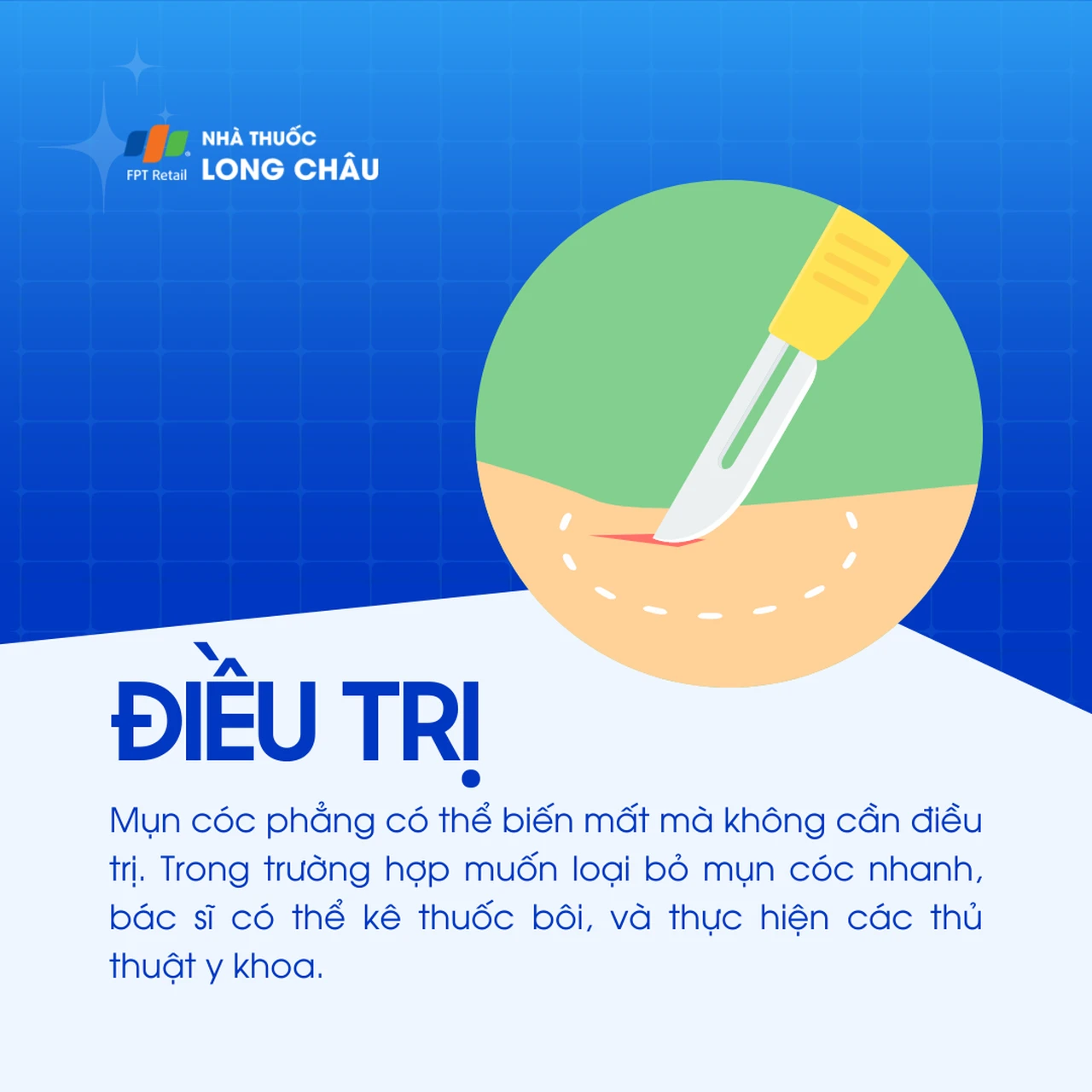 Mụn cóc phẳng  6