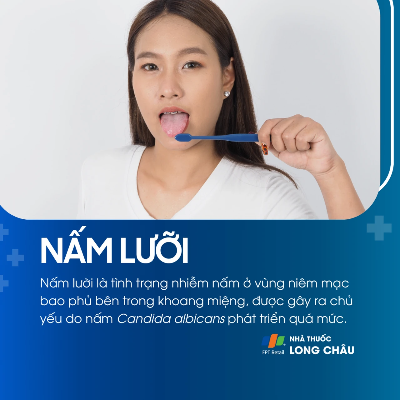 Nấm lưỡi 1