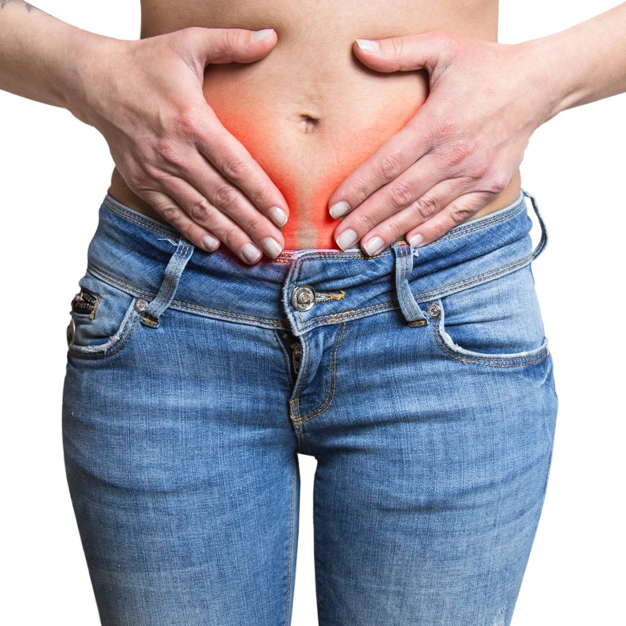 Nang naboth cổ tử cung 1