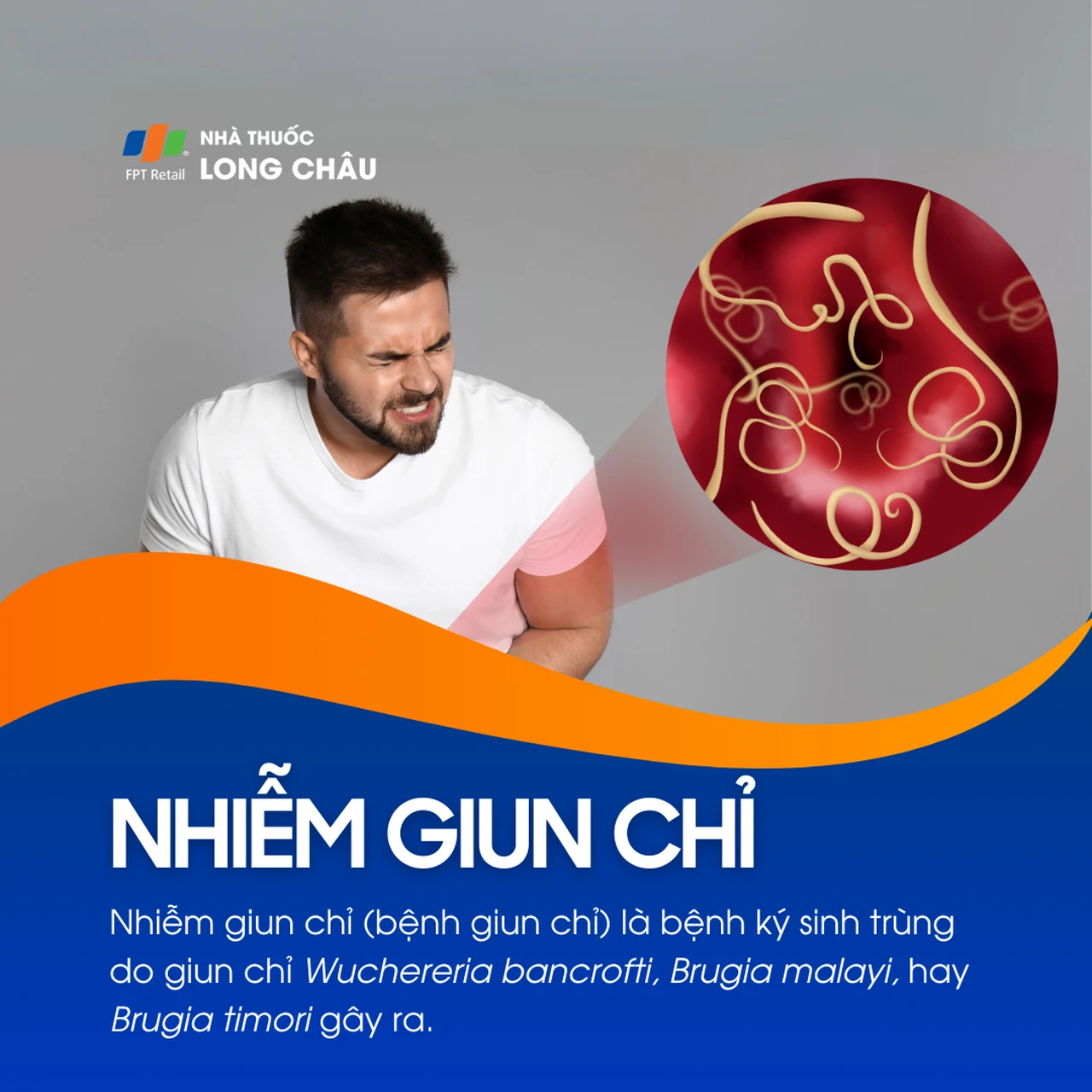 Nhiễm giun chỉ 1