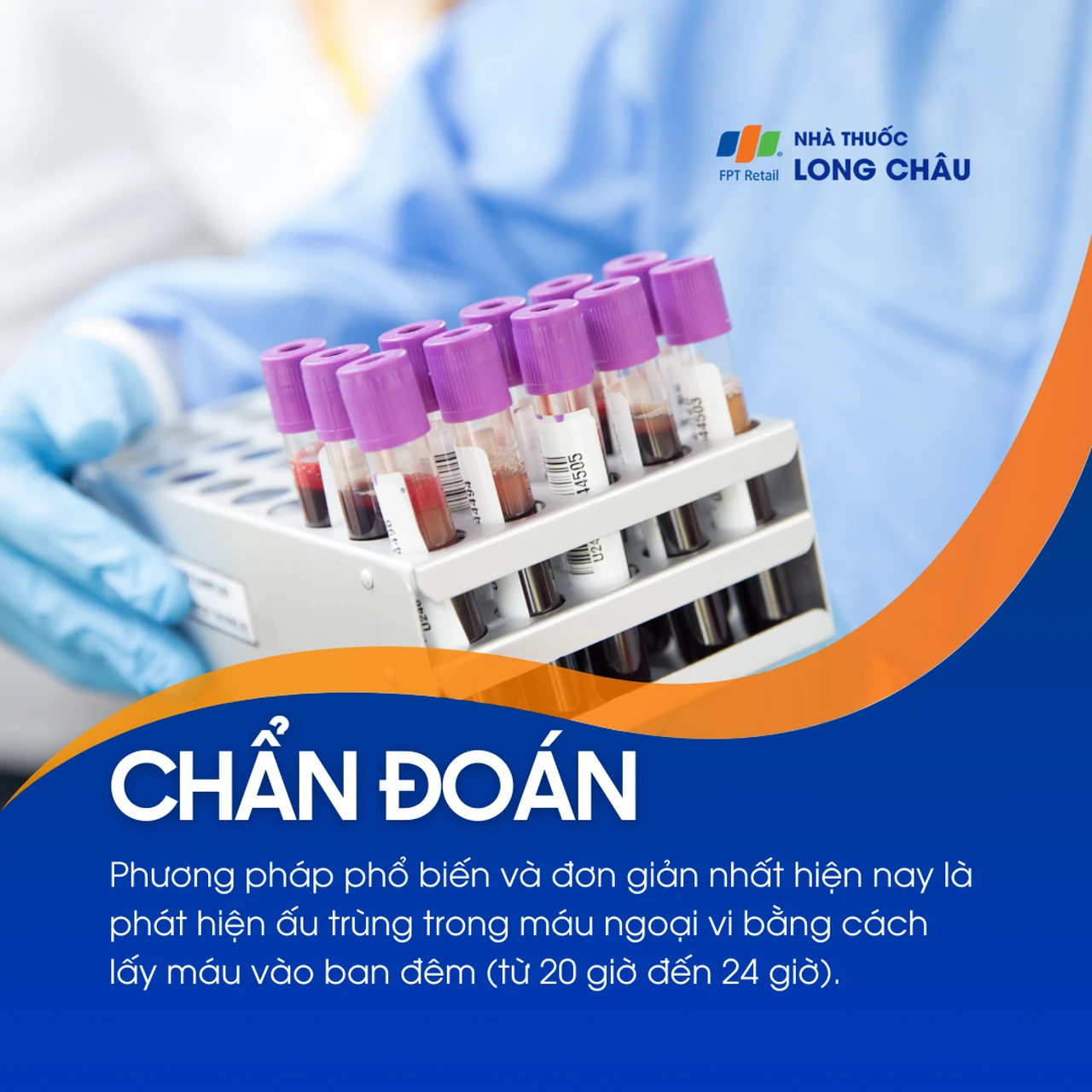 Nhiễm giun chỉ 5