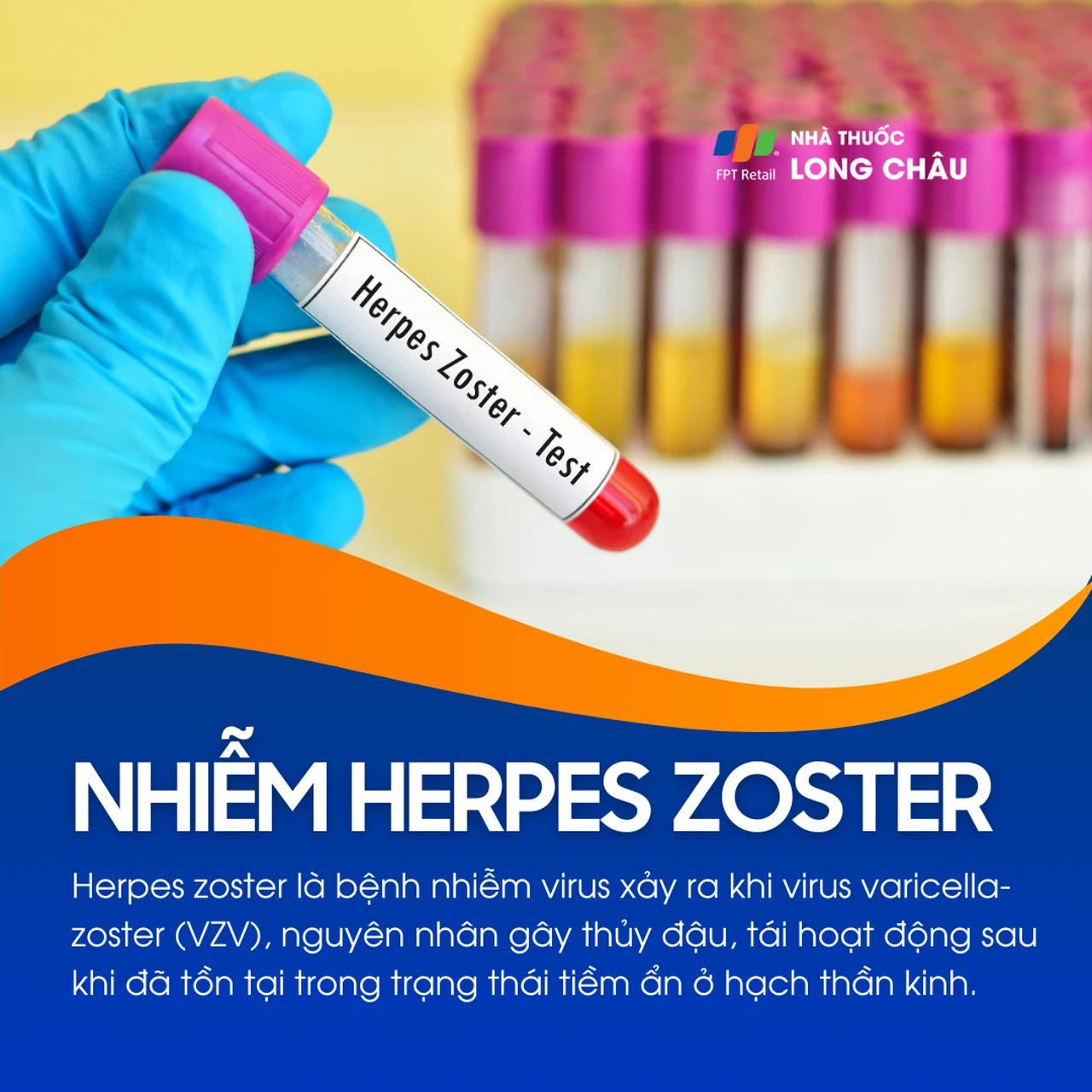 Nhiễm Herpes Zoster 1