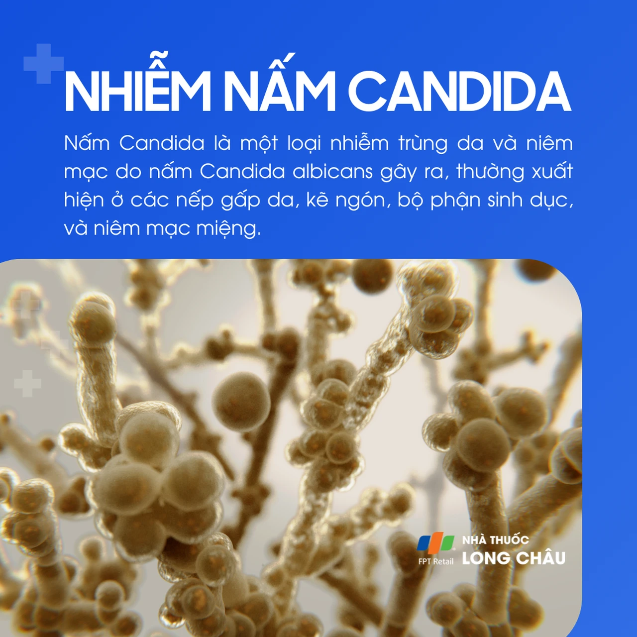 Nhiễm nấm Candida là bệnh nhiễm trùng da và niêm mạc do nấm Candida albicans