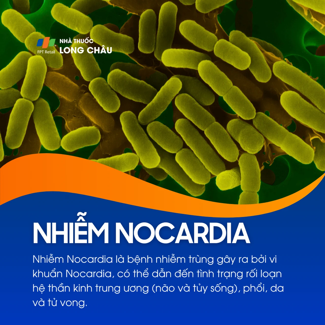 Nhiễm Nocardia 1