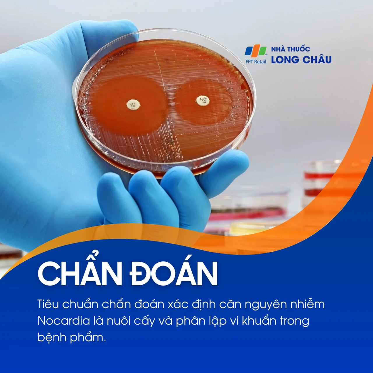 Nhiễm Nocardia 5