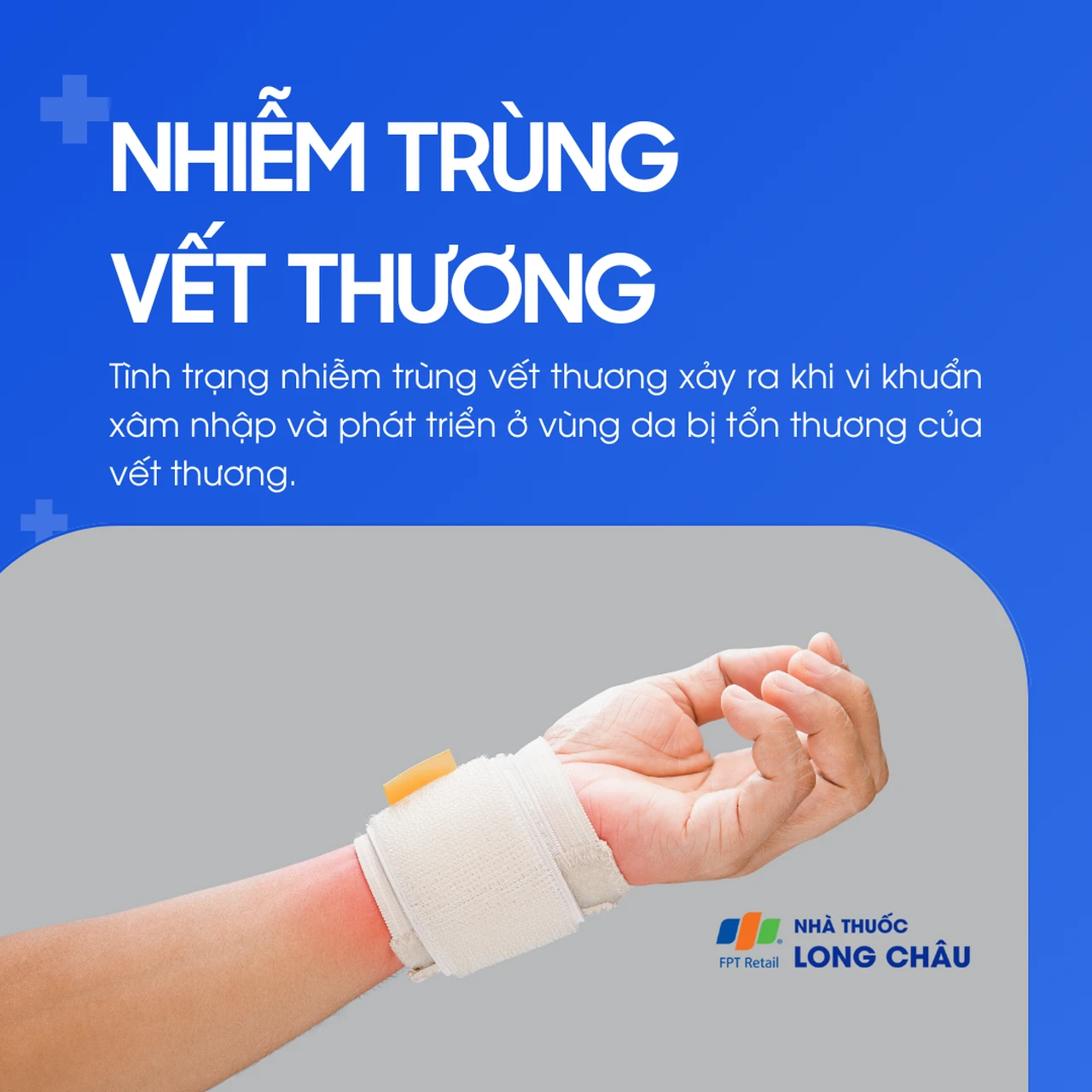Nhiễm trùng vết thương 1
