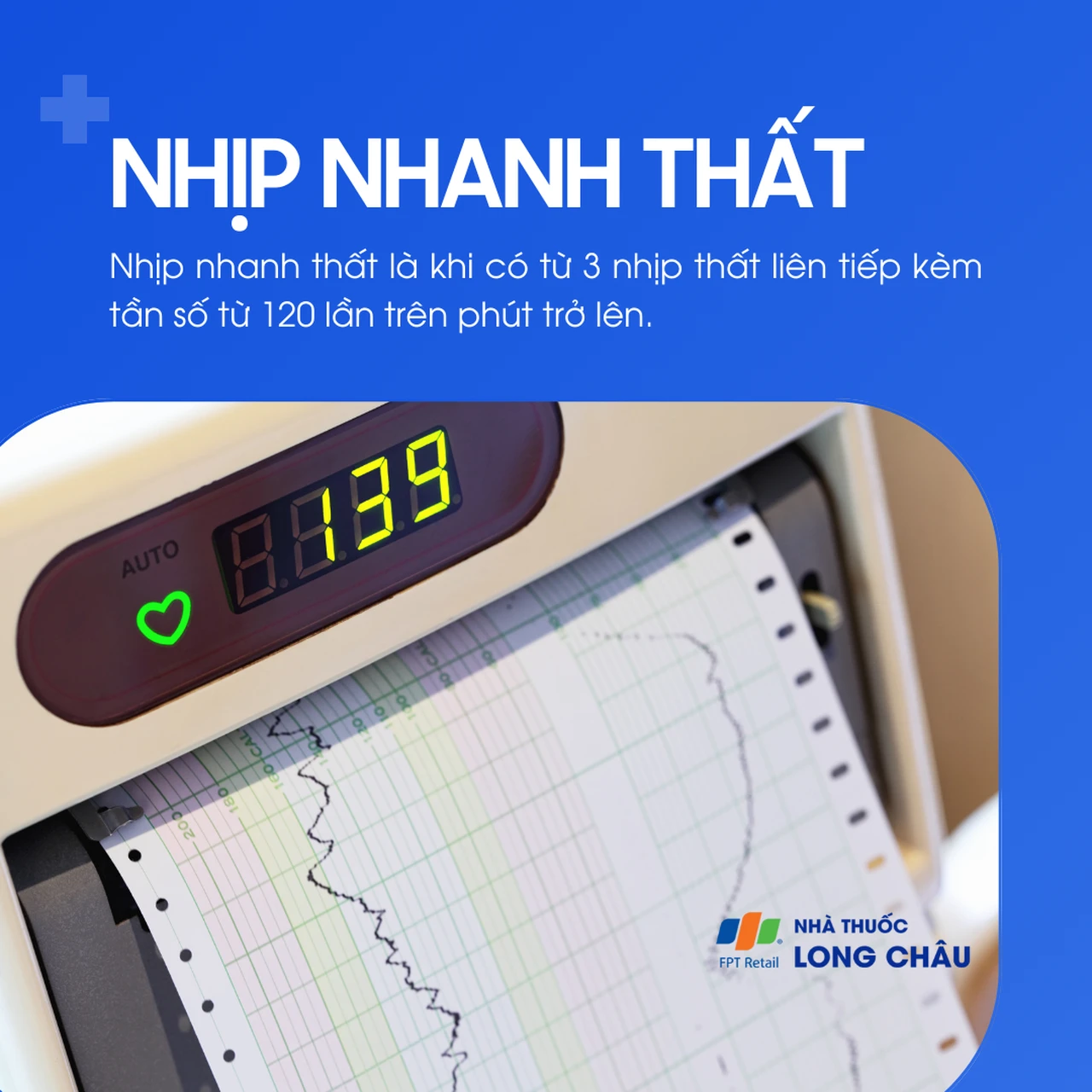 Nhịp nhanh thất 1