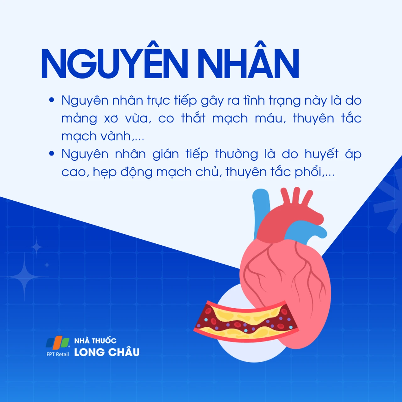 Nhồi máu cơ tim không ST chênh lên 3